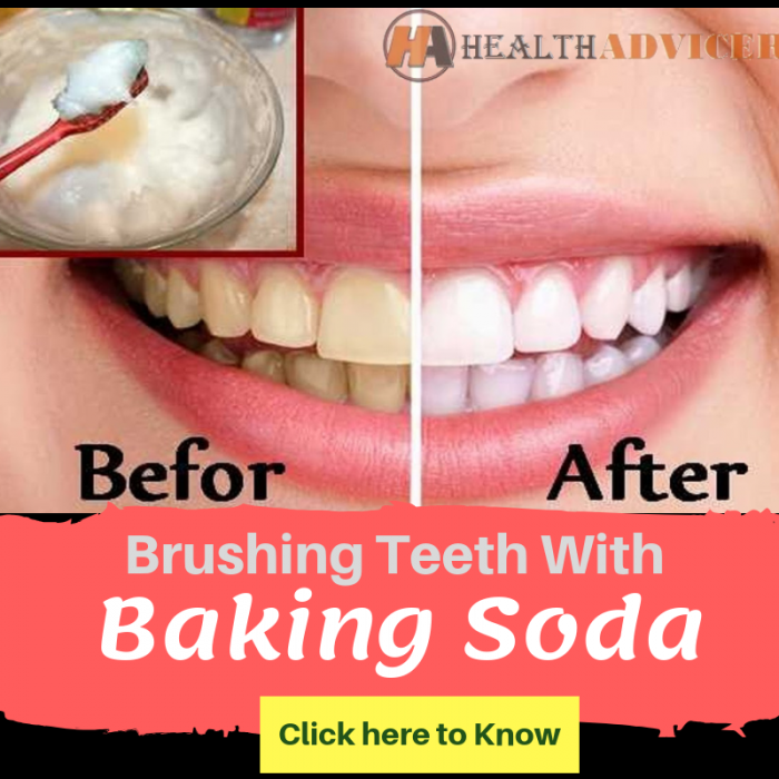 Brushing Teeth With Baking Soda Whiten Your Teeth Easily