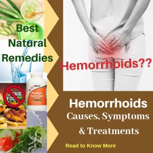 Hemorrhoids : Causes, Picture, Symptoms And Treatments