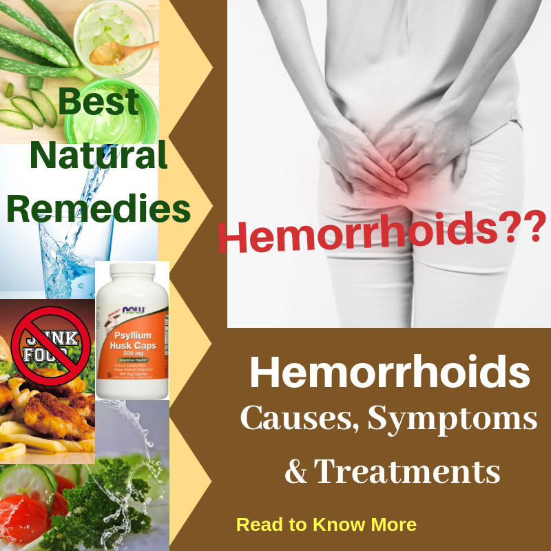 Hemorrhoids Causes Picture Symptoms And Treatments 4547