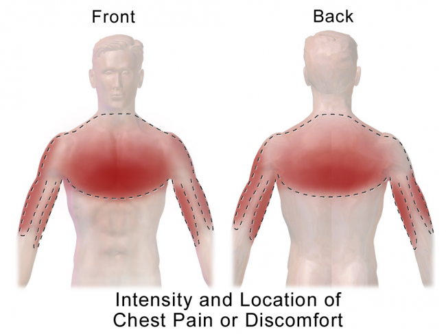 atypical-chest-pain-causes-picture-symptoms-and-treatment