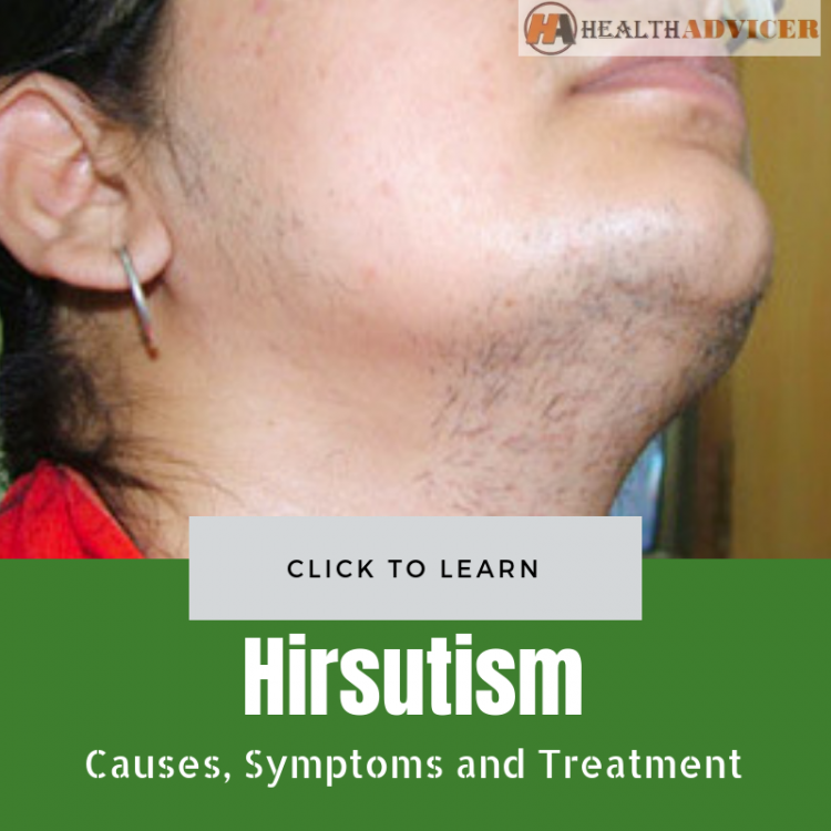 What kind of doctor treats hirsutism, Hirsutism