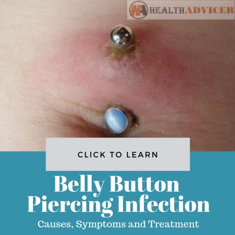 How To Treat an Infected Belly Button Piercing – Cleveland Clinic