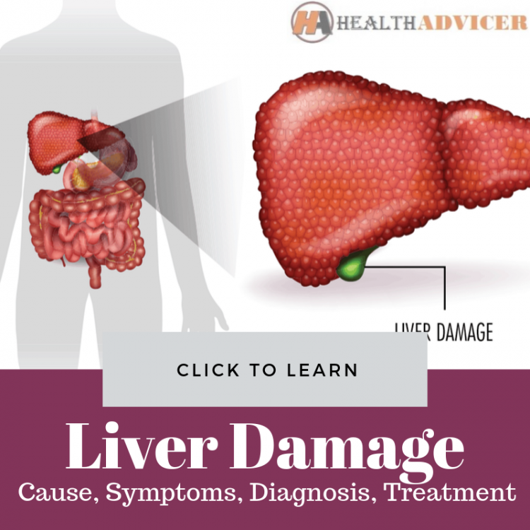 Signs Of Liver Damage Causes Picture Symptoms Treatment | Free Nude ...