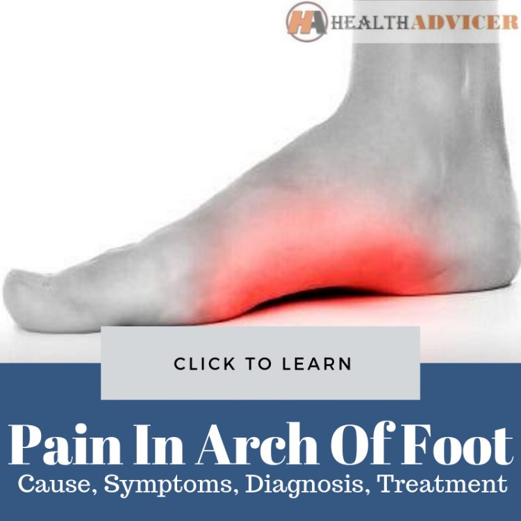 arch pain in foot and back of knee