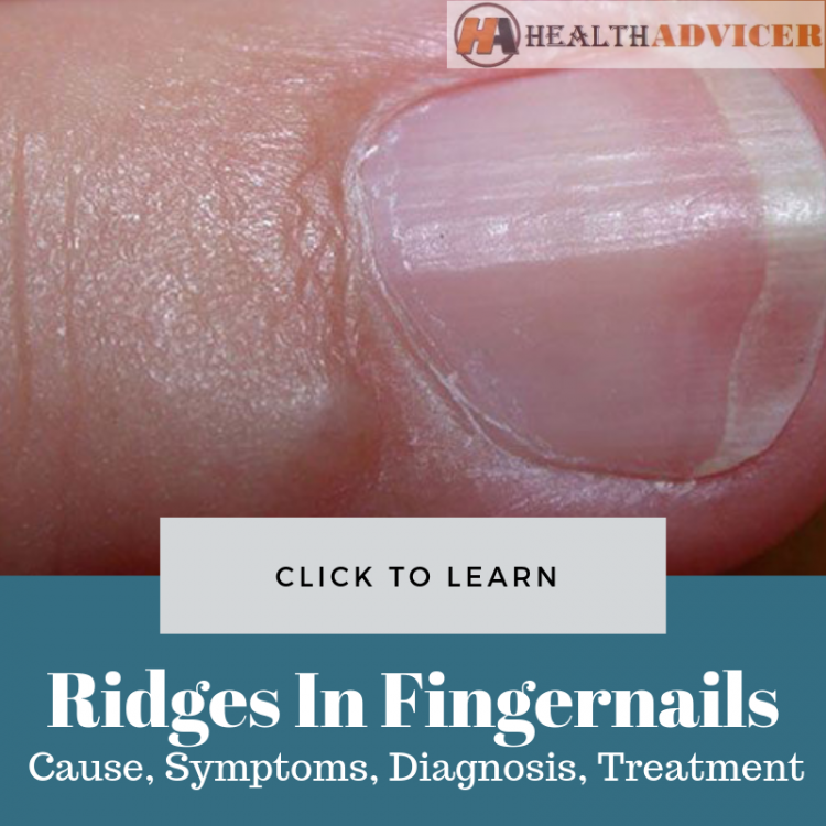 ridges-on-fingernails-causes-picture-symptoms-and-treatment