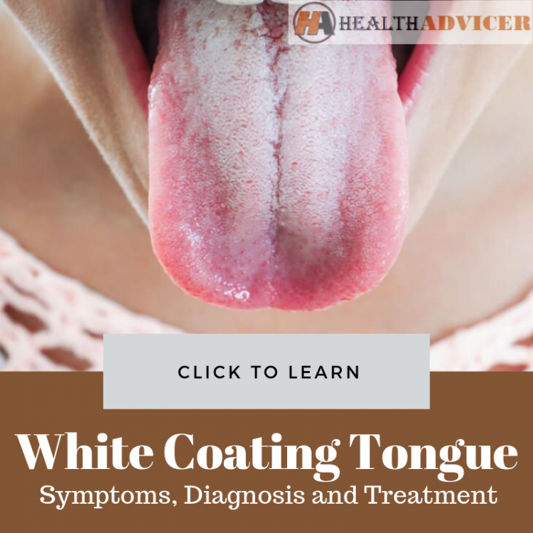 white-coating-on-tongue-causes-picture-symptoms-treatment