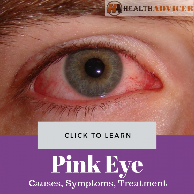 How Many Types Of Pink Eye Are There at June Bailey blog