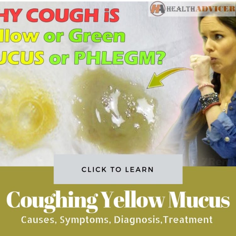 Coughing Yellow Mucus Causes Picture Symptoms Treatment