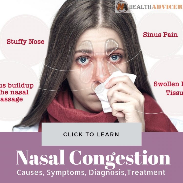 Nasal Congestion Causes, Picture, Symptoms, and Treatment