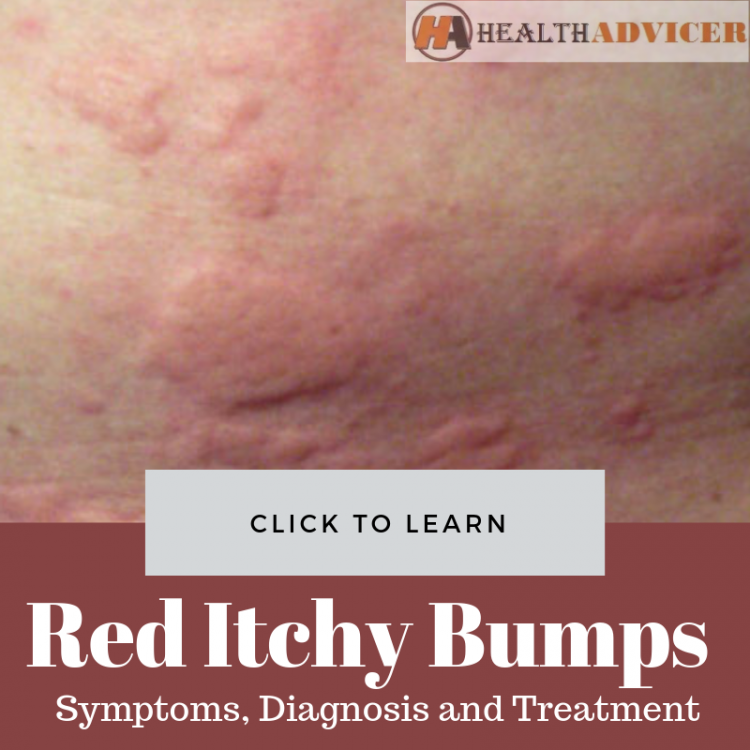 Red Itchy Bumps On The Skin Causes Picture Symptoms Treatment