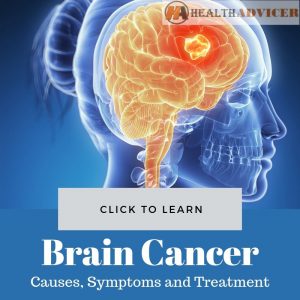 Brain Cancer: Causes, Picture, Symptoms And Treatment