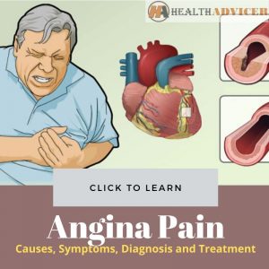 Angina Pain: Causes, Symptoms, Diagnosis And Treatment