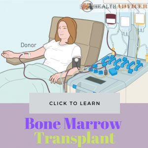 Bone Marrow Transplant: Type, Risks, Preparation, Procedure, Cost, Recovery