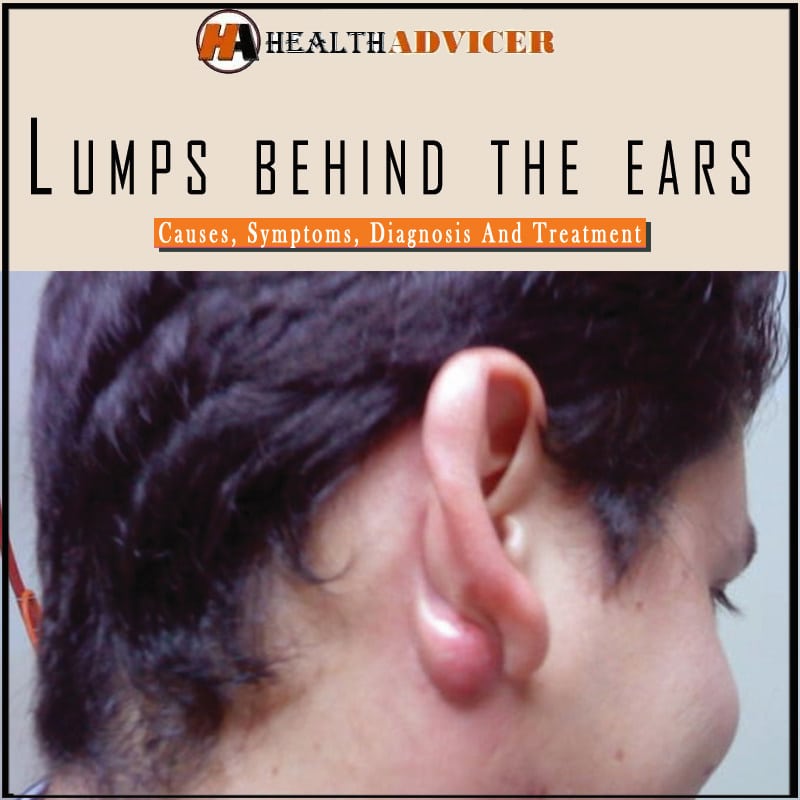 Lumps Behind The Ears Causes Symptoms Diagnosis And Treatment
