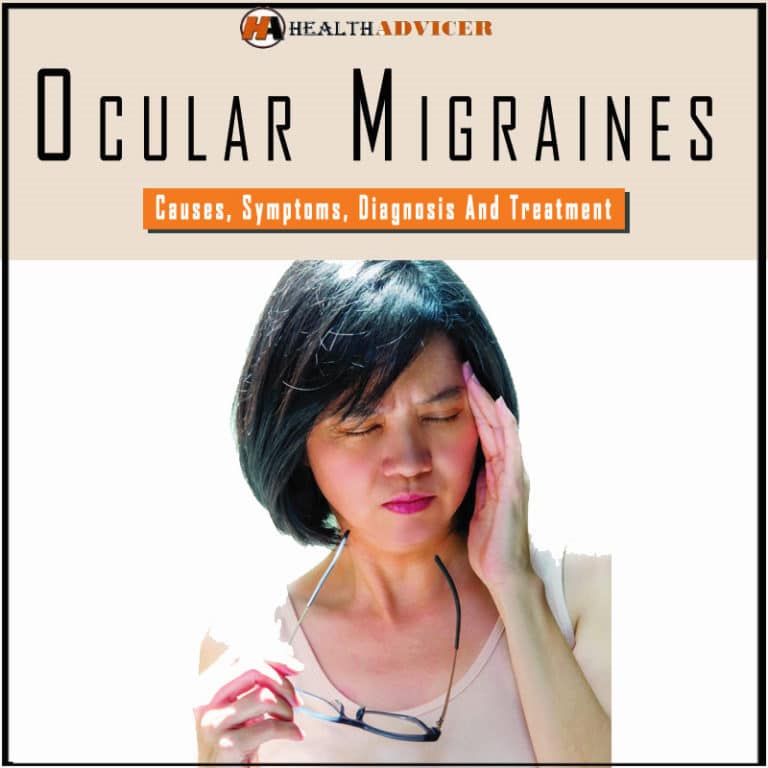 Ocular Migraines Causes Symptoms Diagnosis And Treatment 2490