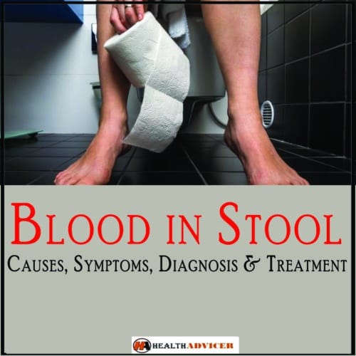 Blood In Stool: Causes, Symptoms, Diagnosis And Treatment